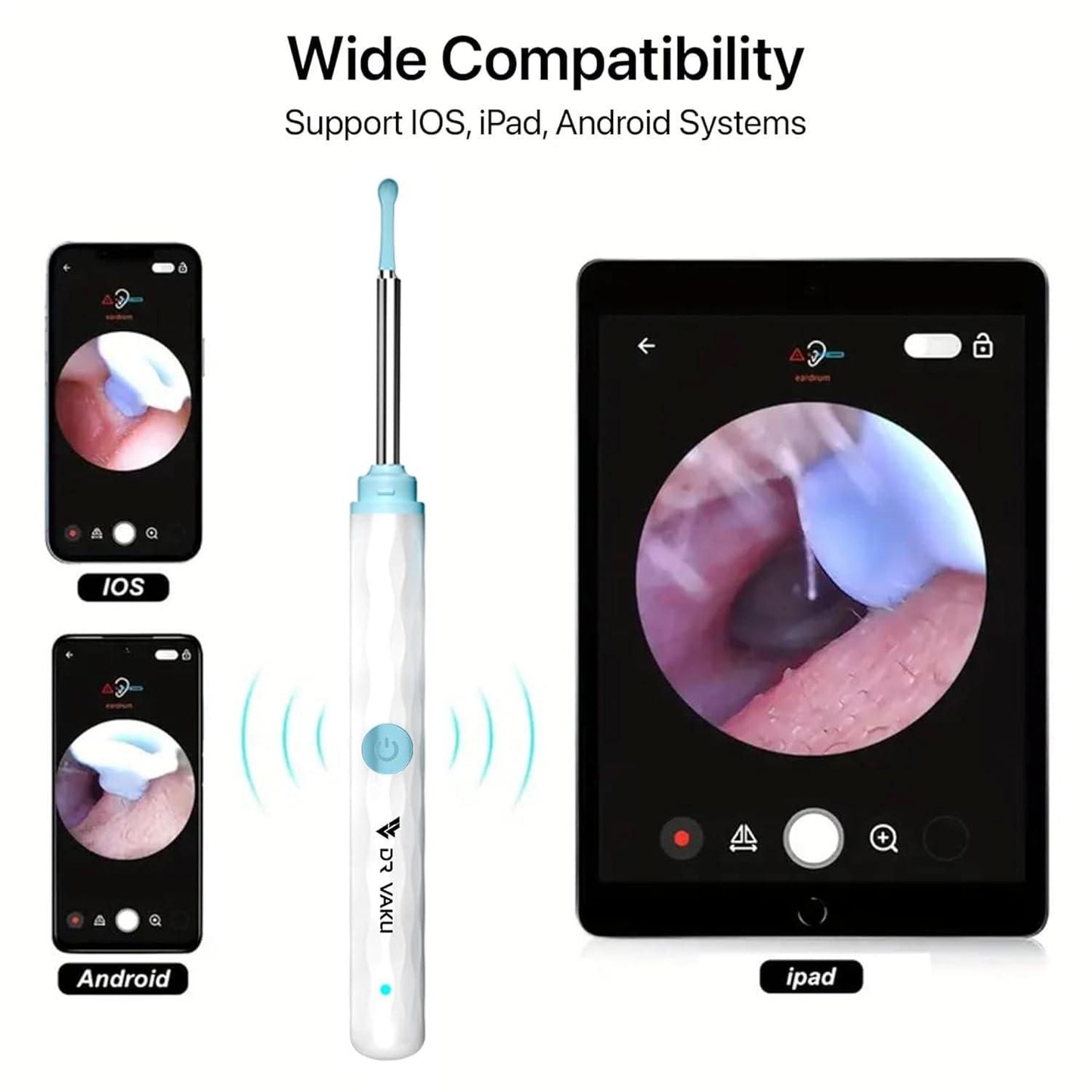Smart Visual Ear Wax Cleaner (Wi-Fi Otoscope)