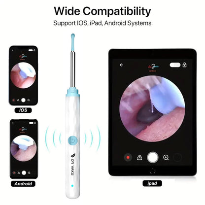 Smart Visual Ear Wax Cleaner (Wi-Fi Otoscope)