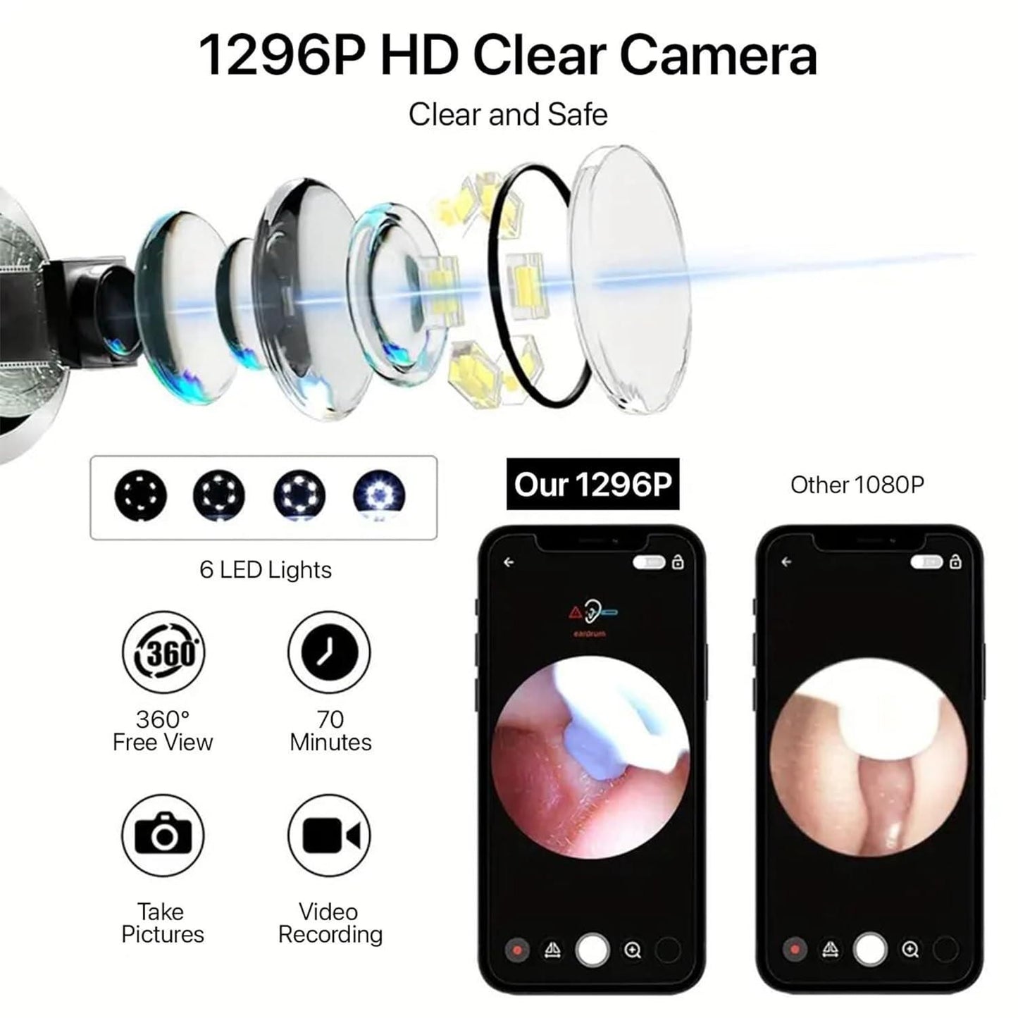 Smart Visual Ear Wax Cleaner (Wi-Fi Otoscope)